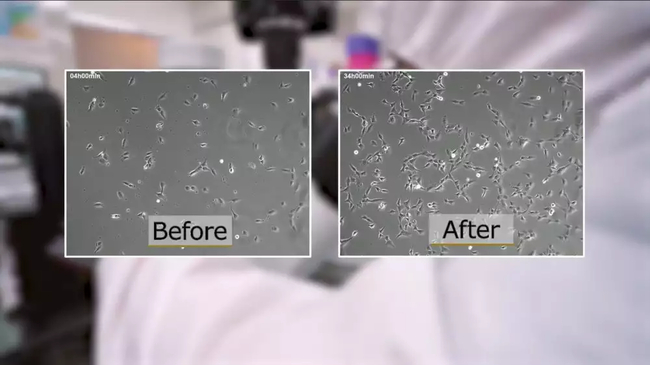 Slider image (8) HELENE  - Stem Cell Clinic